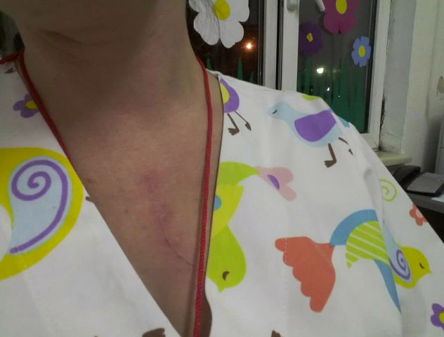 Godet infermieren e Pediatrisë se si mbante fëmijën, procedohet 22-vjeçarja
