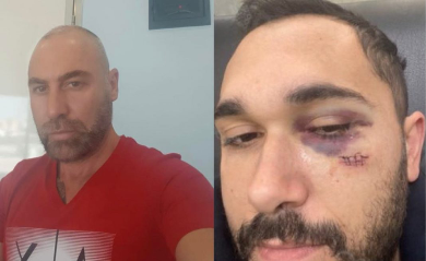 I kapi gruan dhe më pas e rrahu pse u ankua, shkarkohet drejtori i Doganës në Fier, Arlin Lagji