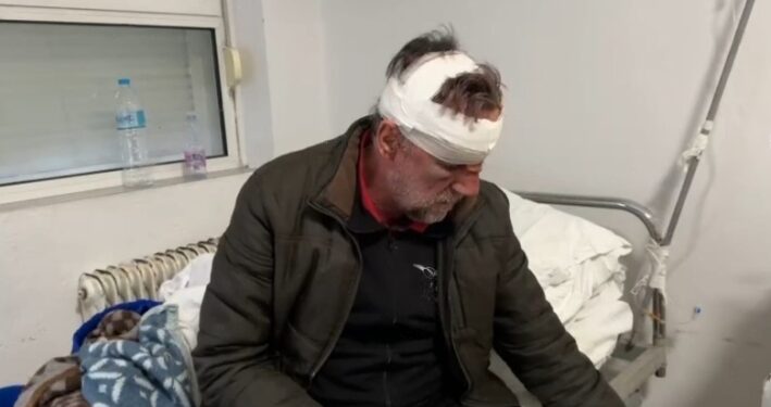 “Më ngacmoi s*ksualisht motrën”, arrestohet i riu që dhunoi mësuesin, policia ndalon edhe 59-vjeçarin. Akuzohet për…