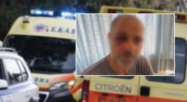 VIDEO- Babë e bir me origjinë shqiptare dhunojnë me bastun grekun në mes të rrugës